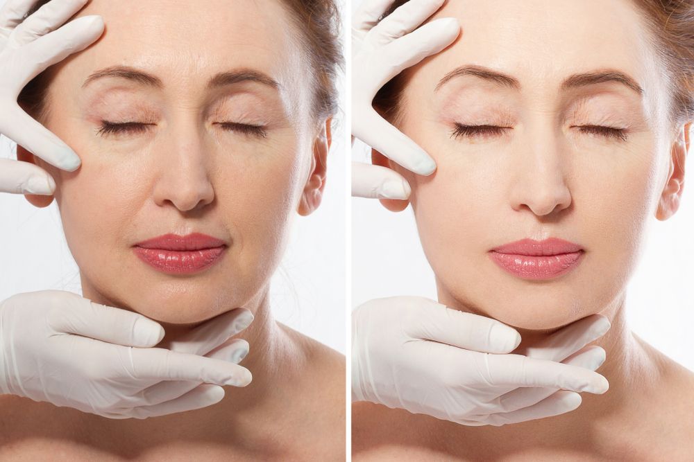 How Juvederm Enhances Your Under-Eye Appearance
