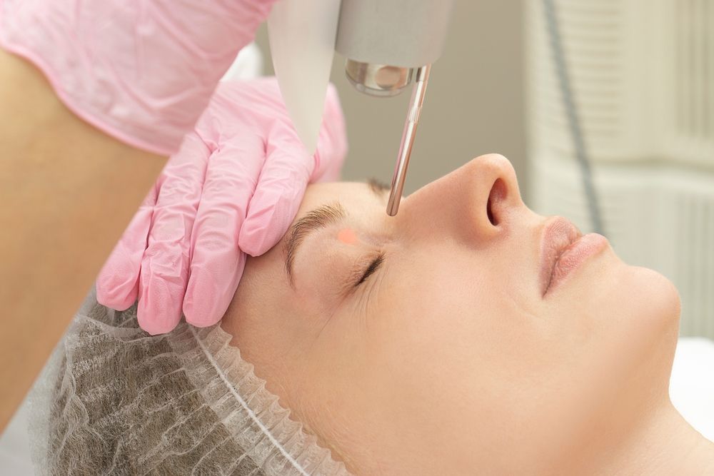 Laser-Lidstraffung: Ablauf, Vorteile und Kostenüberblick