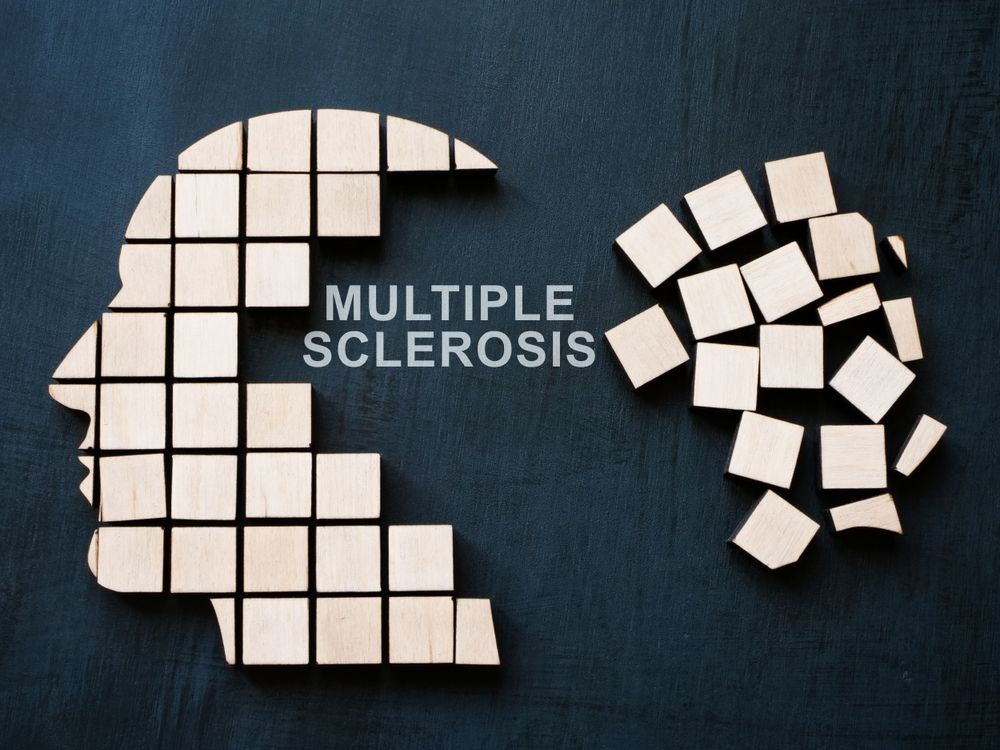 New Treatments Are Changing MS Management for Seniors
